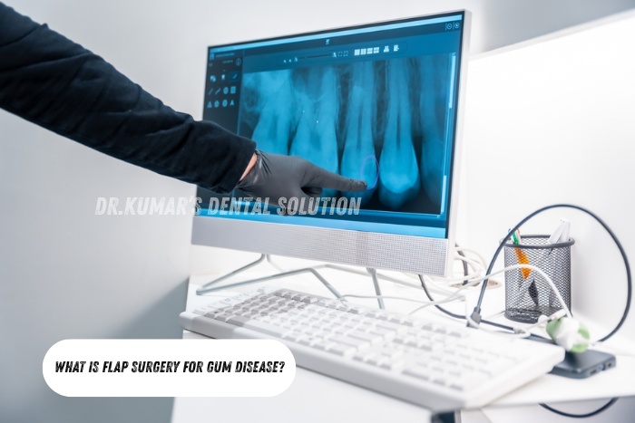 Advanced periodontal diagnosis using digital imaging technology for accurate flap surgery planning