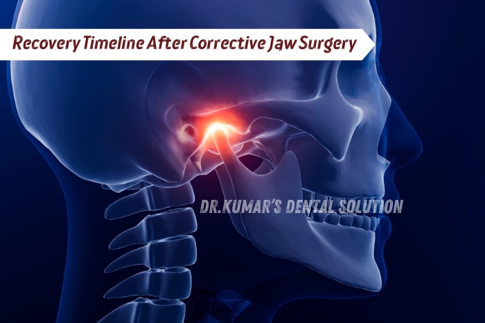 Jaw joint recovery timeline illustration shown at Dr. Kumar’s Dental Solution in Coimbatore, explaining healing stages after corrective