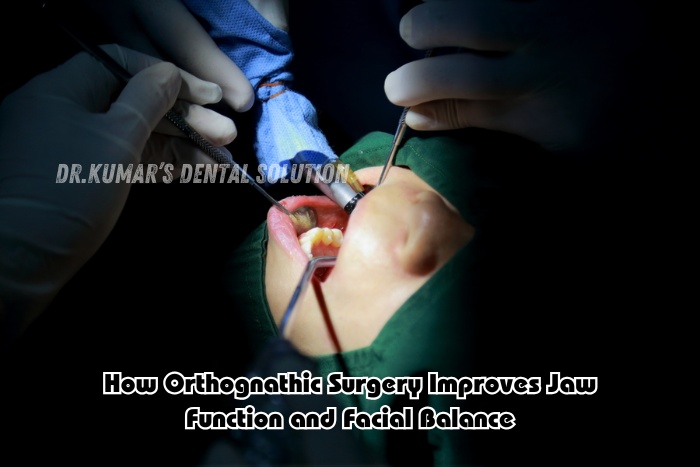Orthognathic jaw surgery procedure performed at Dr.Kumar’s Dental Solution in Coimbatore, advanced dental care for improved jaw function