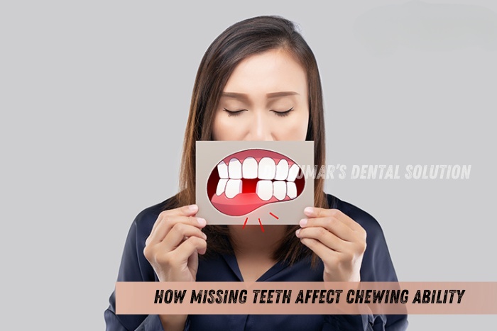 Dental consultation highlighting tooth loss problems and need for prosthetic replacements or implants