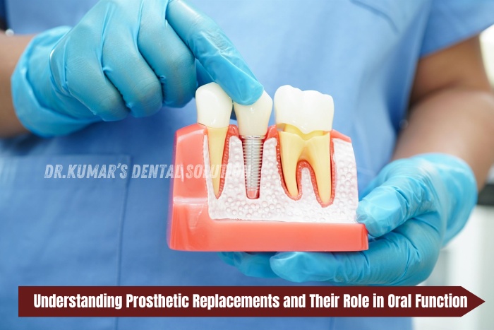 Dental implant and prosthetic tooth replacement model explained by dentist at Nataraj Dentistry in Coimbatore