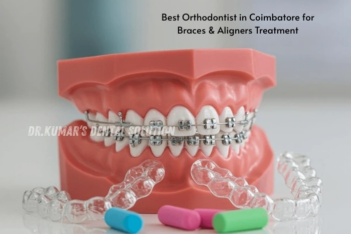 Orthodontic braces and clear aligners model used for teeth straightening treatment at Nataraj Dentistry in Coimbatore