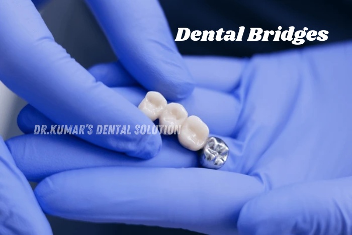 Trusted dental clinic in Coimbatore offering durable and natural-looking dental bridge solutions