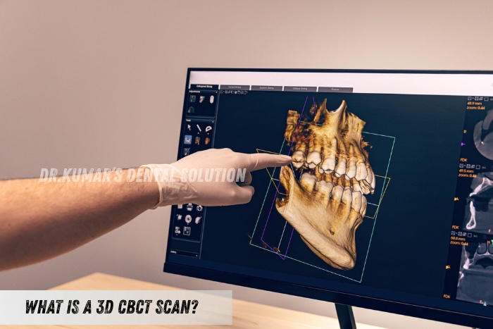 3D CBCT scan showing detailed jaw structure for accurate dental diagnosis at Nataraj Dentistry in Coimbatore